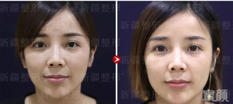 https://img.yiyiaimei.com/mnt/timg/200218/1206252S5-1.jpg