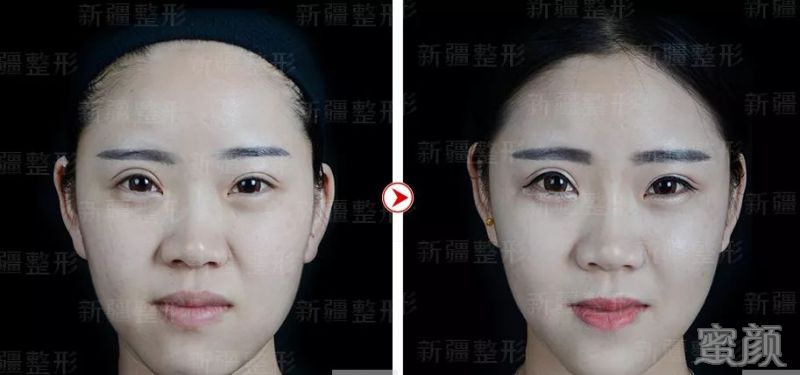 https://img.yiyiaimei.com/mnt/timg/200218/12062C646-3.jpg