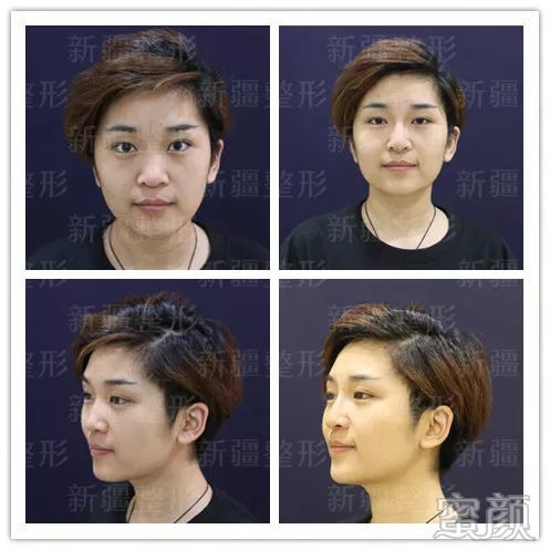 https://img.yiyiaimei.com/mnt/timg/200218/12062Q194-5.jpg