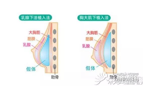 案例图片