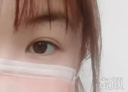 案例图片