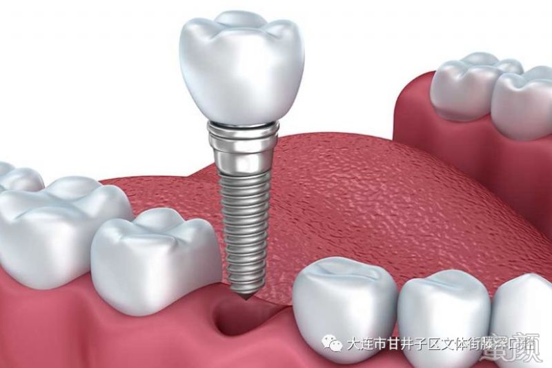 https://img.yiyiaimei.com/mnt/timg/200218/135942CJ-3.jpg