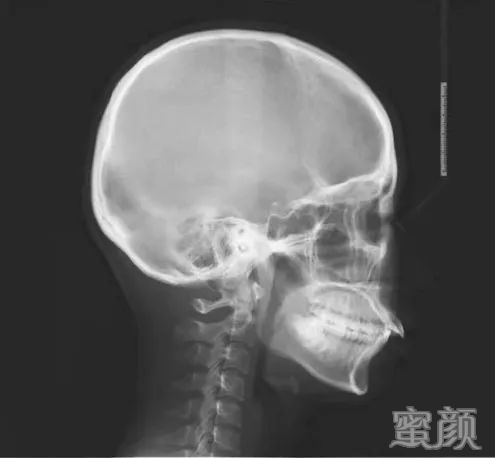案例图片