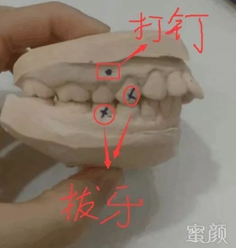 案例图片