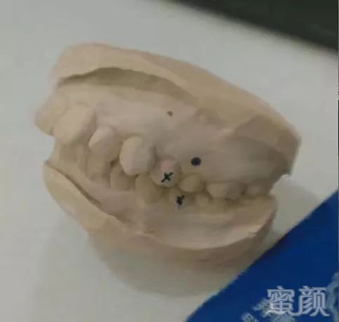 案例图片