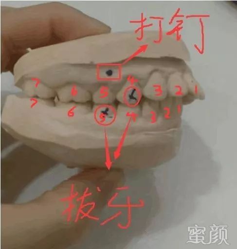 案例图片