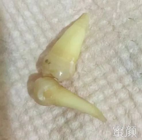 案例图片