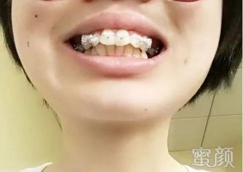 案例图片