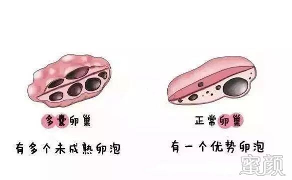 https://img.yiyiaimei.com/mnt/timg/200219/132A52X5-3.jpg