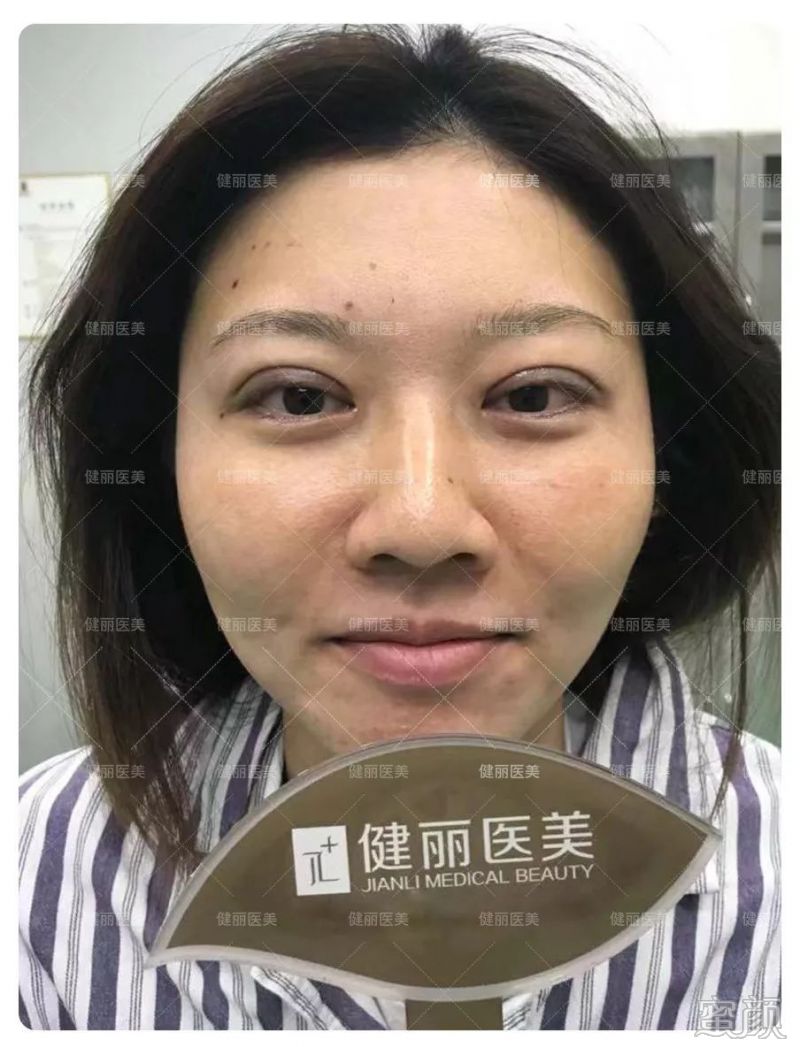 案例图片