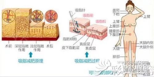 案例图片
