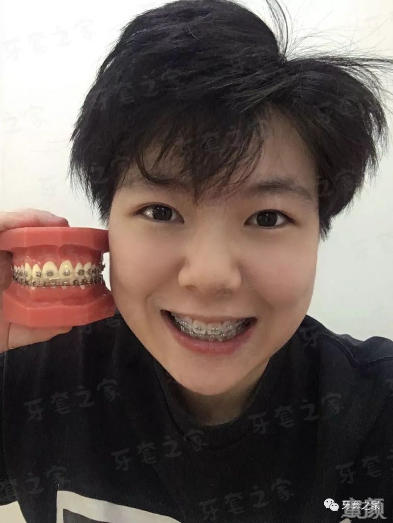 案例图片