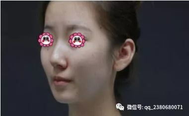 https://img.yiyiaimei.com/mnt/timg/200220/14123353I-0.jpg