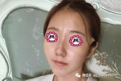 https://img.yiyiaimei.com/mnt/timg/200220/1412341320-1.jpg
