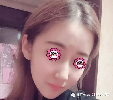 https://img.yiyiaimei.com/mnt/timg/200220/1412351D7-2.jpg
