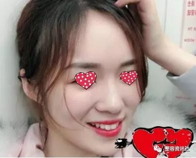 https://img.yiyiaimei.com/mnt/timg/200220/1431092C5-3.jpg