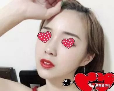 https://img.yiyiaimei.com/mnt/timg/200220/14310R011-2.jpg