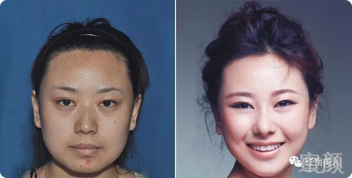 案例图片