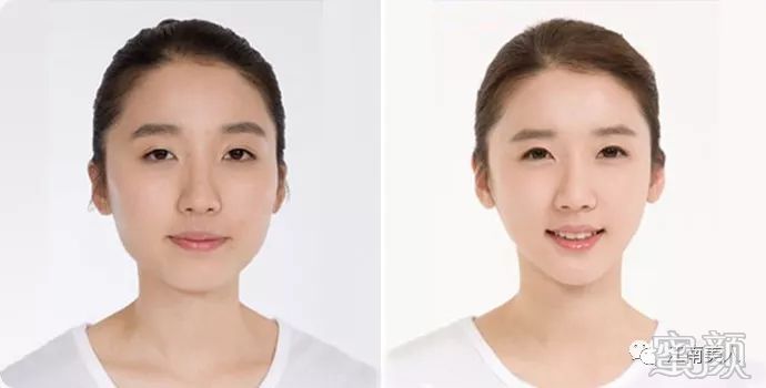 案例图片