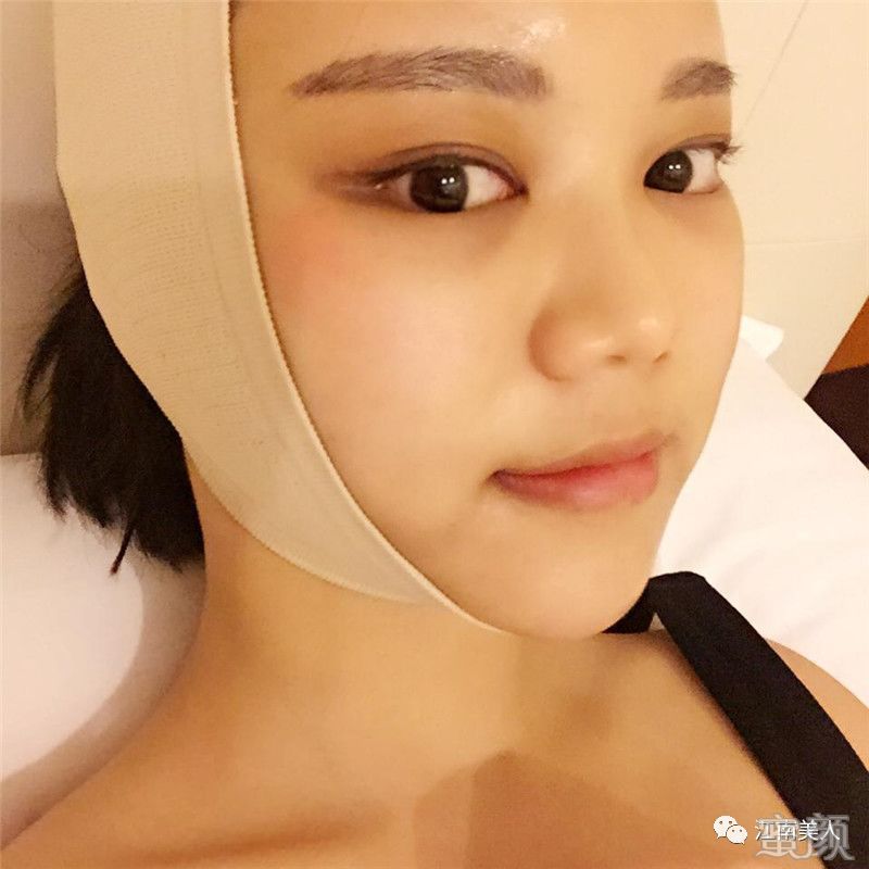 案例图片
