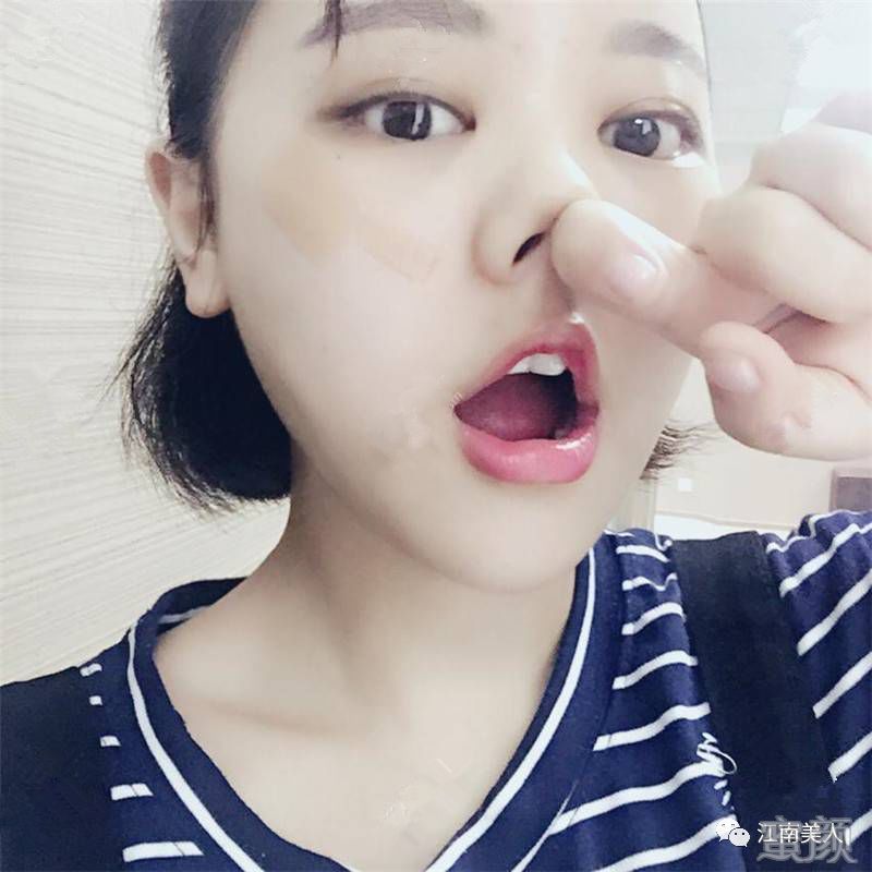 案例图片