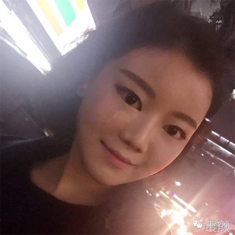 案例图片