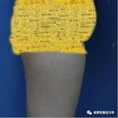 https://img.yiyiaimei.com/mnt/timg/200220/14335a953-0.jpg