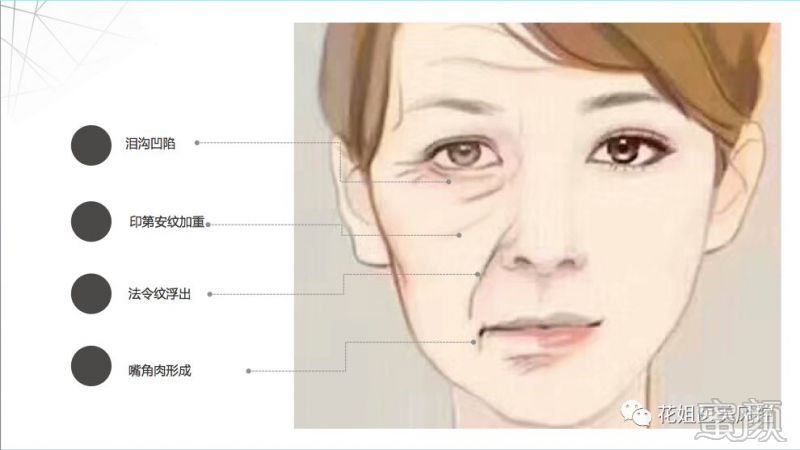 https://img.yiyiaimei.com/mnt/timg/200220/1440464P9-0.jpg