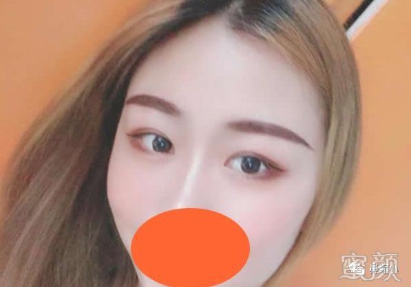 案例图片