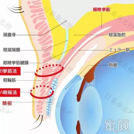 案例图片