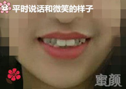 案例图片