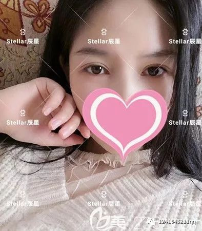 案例图片