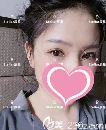案例图片