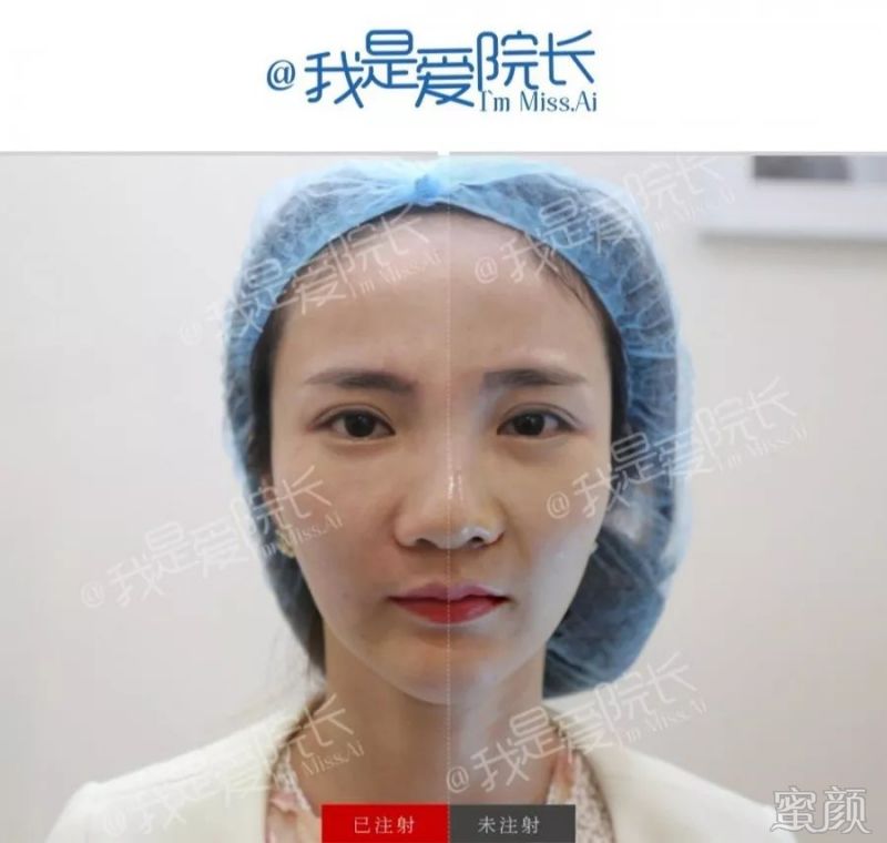 https://img.yiyiaimei.com/mnt/timg/200221/13232a153-5.jpg