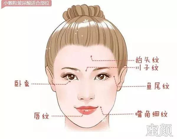https://img.yiyiaimei.com/mnt/timg/200221/13233035V-7.jpg