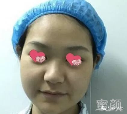 案例图片