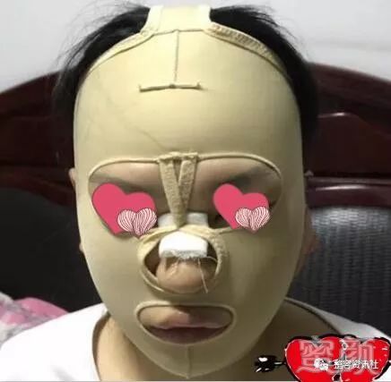 案例图片