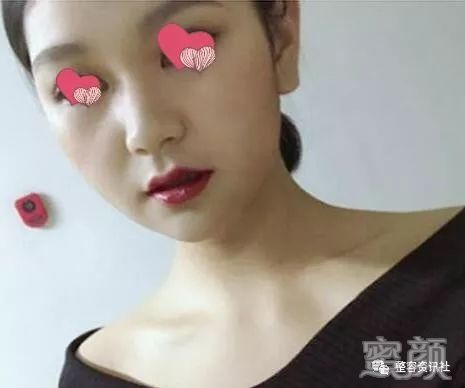 案例图片