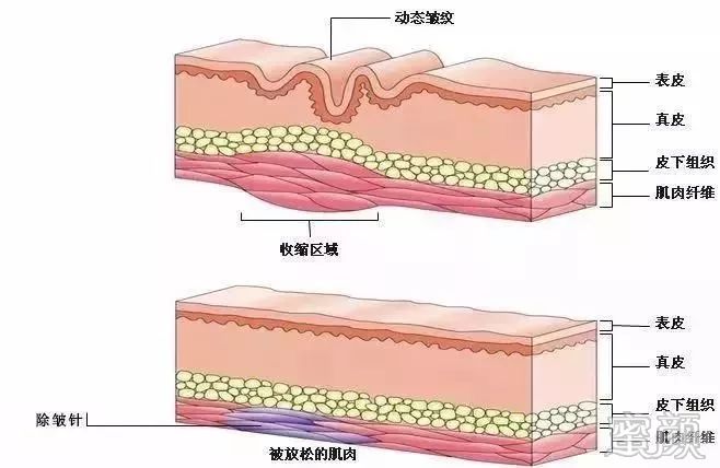 案例图片