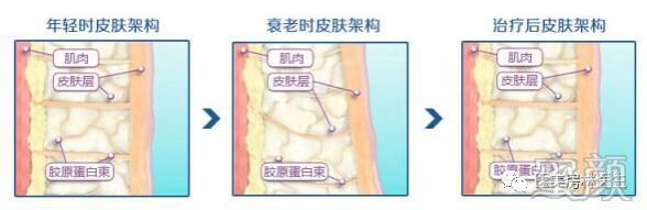 案例图片