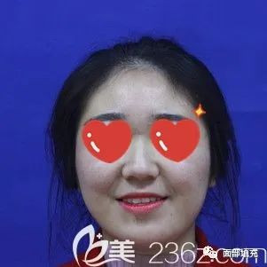 https://img.yiyiaimei.com/mnt/timg/200222/134AHC6-0.jpg
