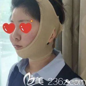 https://img.yiyiaimei.com/mnt/timg/200222/134AR2b-1.jpg