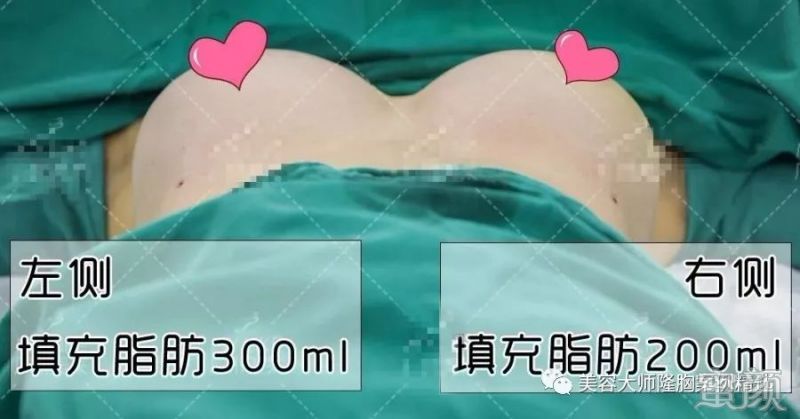 https://img.yiyiaimei.com/mnt/timg/200222/1351591553-6.jpg 案例图片