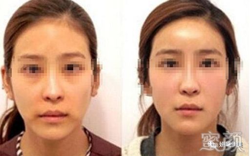 https://img.yiyiaimei.com/mnt/timg/200222/14012G3H-0.jpg