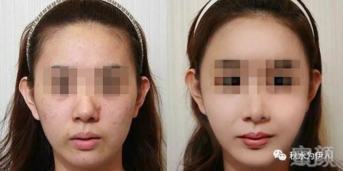 https://img.yiyiaimei.com/mnt/timg/200222/140610GN-0.jpg