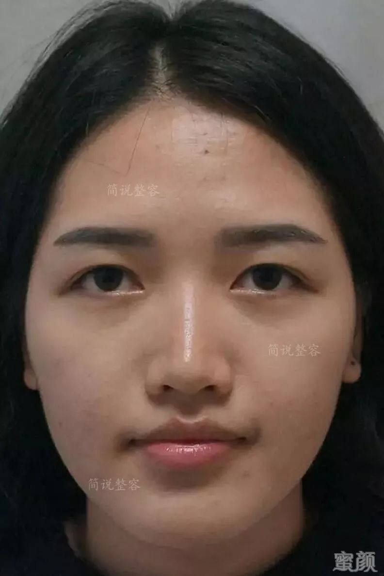 https://img.yiyiaimei.com/mnt/timg/200222/14215T4Q-0.jpg