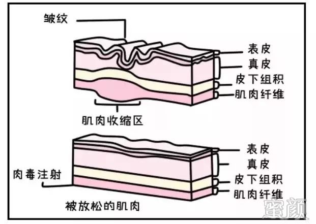 案例图片