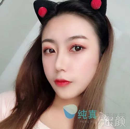 案例图片