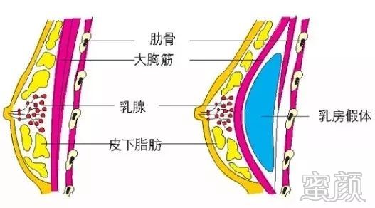 案例图片