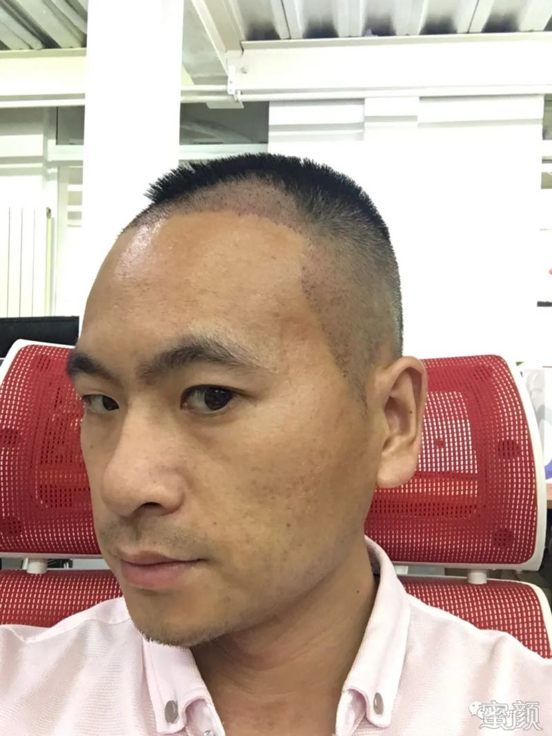 https://img.yiyiaimei.com/mnt/timg/200224/1339593505-1.jpg 案例图片
